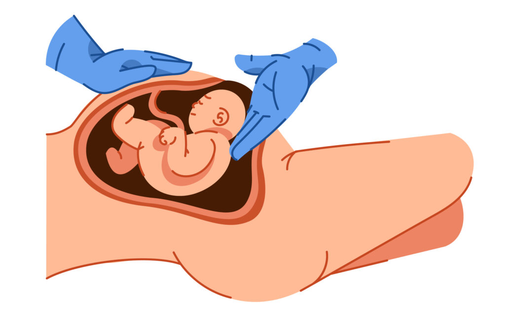 C section