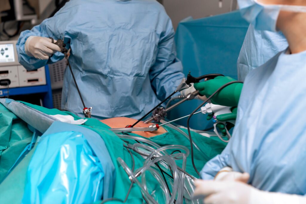 Laparoscopic Hysterectomy: A Minimally Invasive Solution for Women