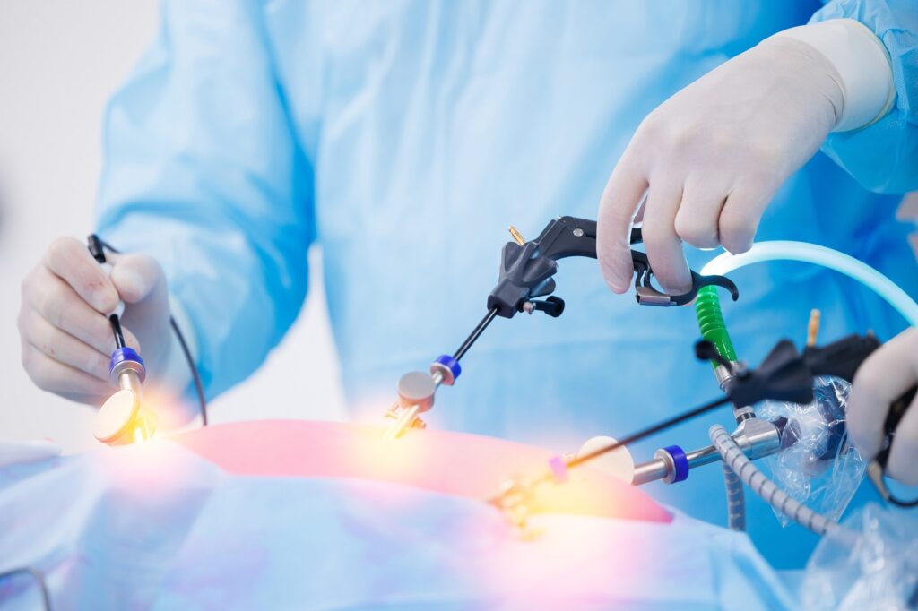 Laparoscopic Hysterectomy: What You Need to Know?